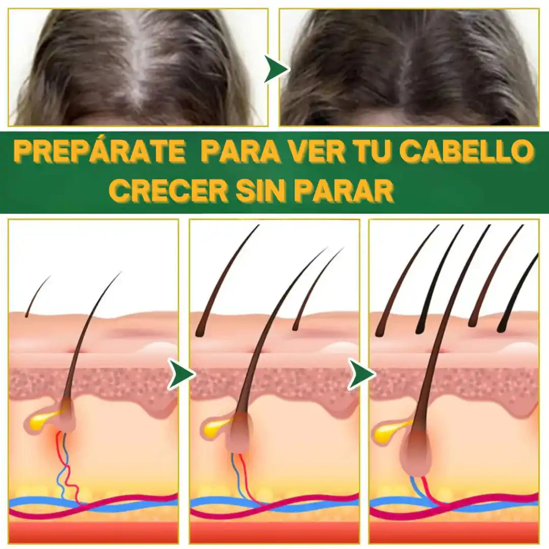 Compra 1 y Lleva 2 ELIXIR CAPILAR OUHOE - Has Crecer tu Cabello en 14 Dias.🦁
