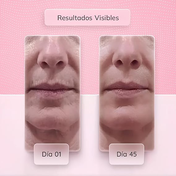 MASAJEADOR ESTIRAMIENTO FACIAL➕ENVIO GRATIS