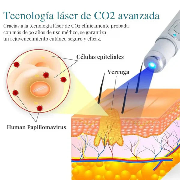 Lápiz Láser para Eliminar Lunares y Verrugas ➕ Envío Gratis