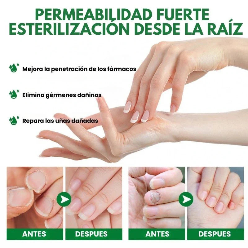 PAGUE 1 Y LLEVE 2 🚚 Serum para Uñas Fuertes, Largas y Sin Hongos💅