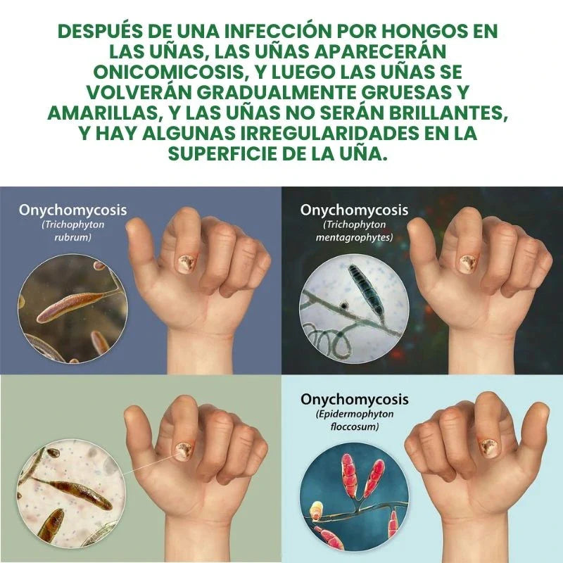 PAGUE 1 Y LLEVE 2 🚚 Serum para Uñas Fuertes, Largas y Sin Hongos💅