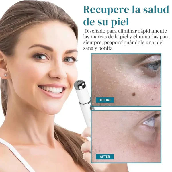 Lápiz Láser para Eliminar Lunares y Verrugas ➕ Envío Gratis