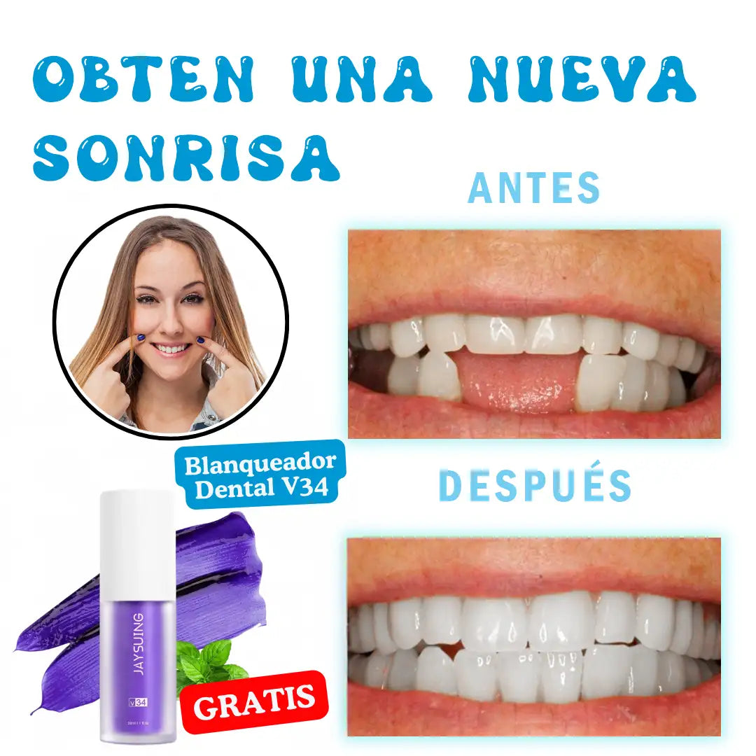 ORIGINAL MOLDATEET®️ ➕ Blanqueador Dental V34 GRATIS - RECUPERA TU SONRISA AL INSTANTE😀