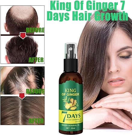CUIDA Y RESTAURA CADA FOLICULO DE TU CABELLO Y BARBA➕COMPRA 4 C/U $28.725 pesos