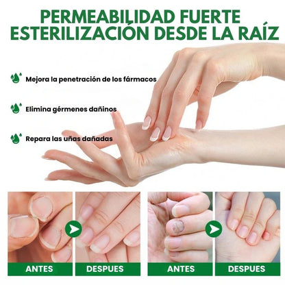 PAGUE 1 Y LLEVE 2 🚚 Serum para Uñas Fuertes, Largas y Sin Hongos💅