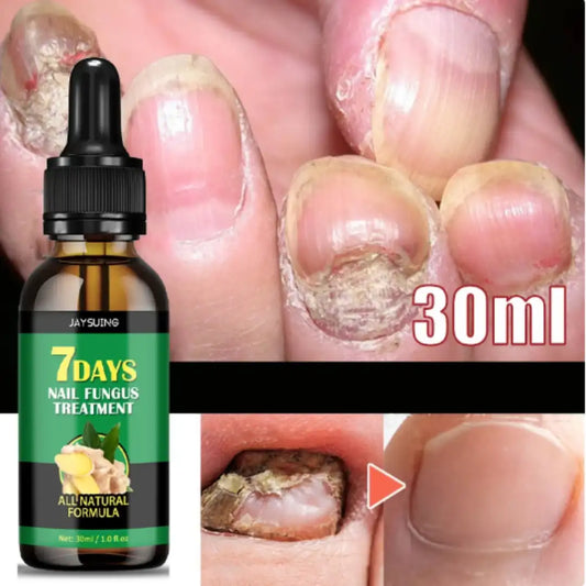 PAGUE 1 Y LLEVE 2 🚚 Serum para Uñas Fuertes, Largas y Sin Hongos💅